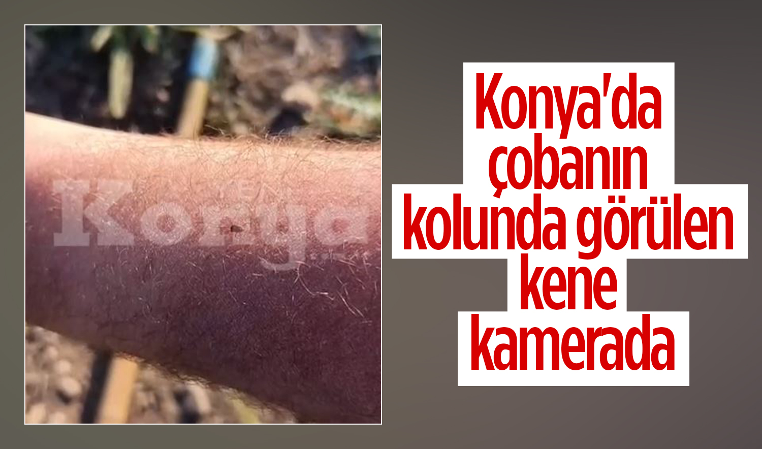 Konya’da çobanın kolunda görülen kene kamerada