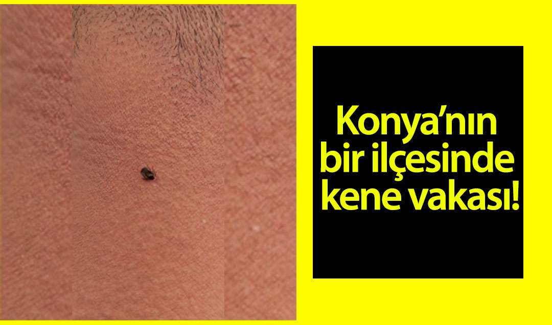 Konya’nın bir ilçesinde kene vakası!
